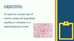 Ovarian Leydig Cell Hyperplasia: An Unusual Case of Virilization in a Postmenopausal Woman