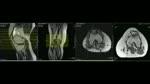 Protocolo Básico de rodilla en rm siemens