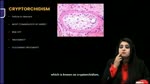 38 Pathology of Male Genital Tract_watermark.mp4